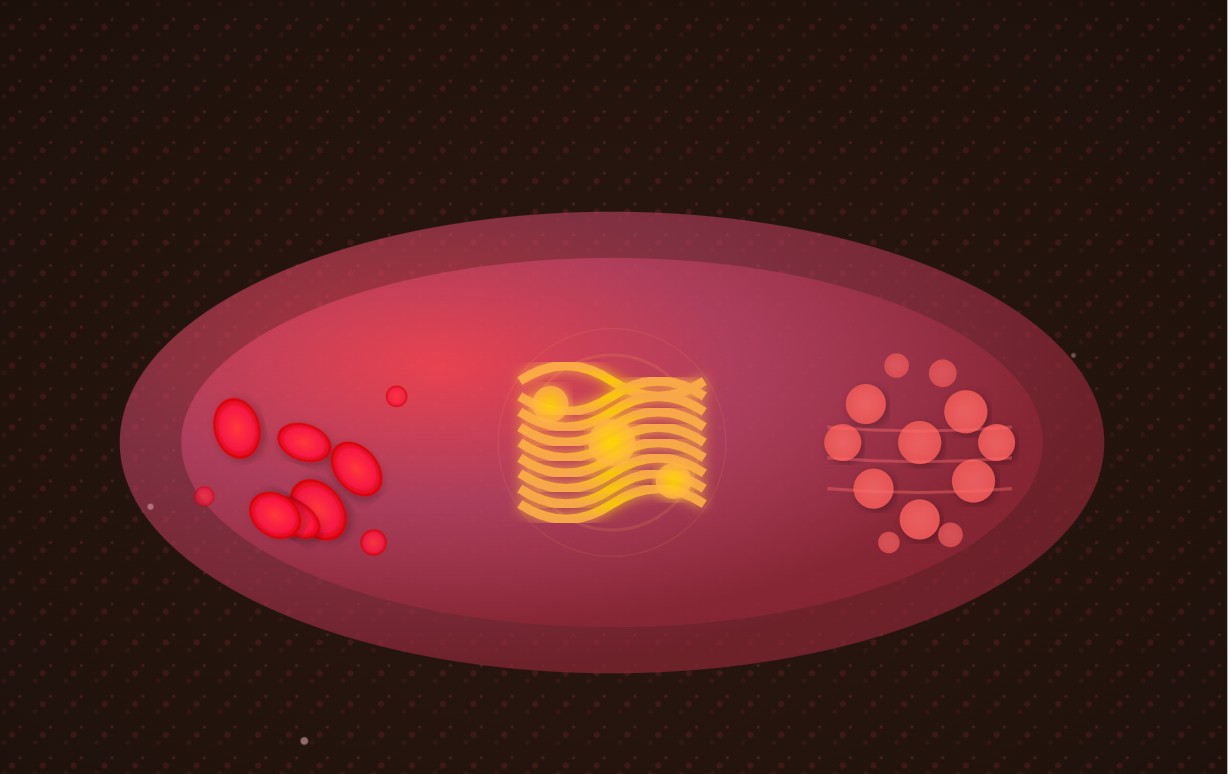 Una nueva investigación identifica genes clave que actúan como freno en el crecimiento del cáncer de sangre