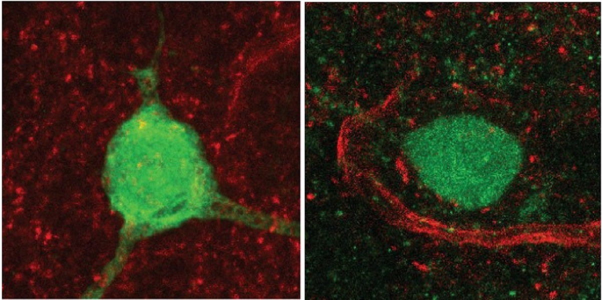 Una mutación genética vinculada al autismo reduce los niveles de una hormona clave para la conducta social