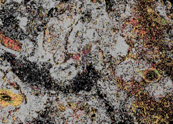 Investigadores del CNAG descifran el líquido cefalorraquídeo como herramienta para comprender la progresión de las enfermedades cerebrales