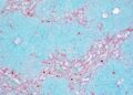 Un estudio del CNIO descubre un mecanismo de las vías biliares que puede ayudar a personalizar el tratamiento de la fibrosis hepática