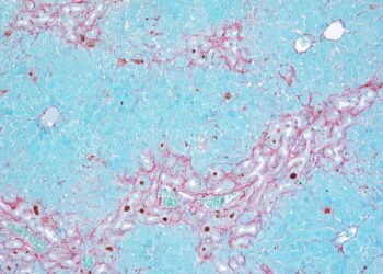 Un estudio del CNIO descubre un mecanismo de las vías biliares que puede ayudar a personalizar el tratamiento de la fibrosis hepática