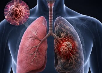 Más allá de los Linfocitos T: Cómo las Células NK $CD39^{+}$ Revolucionan el Tratamiento del Cáncer de Pulmón