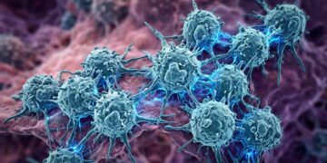 Se revelan los factores ocultos que impulsan el cáncer infantil agresivo