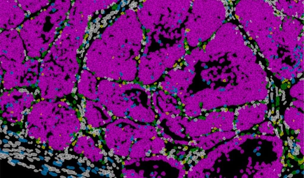 20-04-26NietoNatureCancer