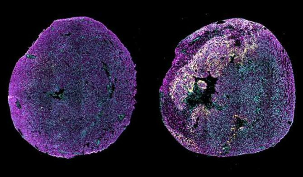 8577_nueva-terapia-con-arn