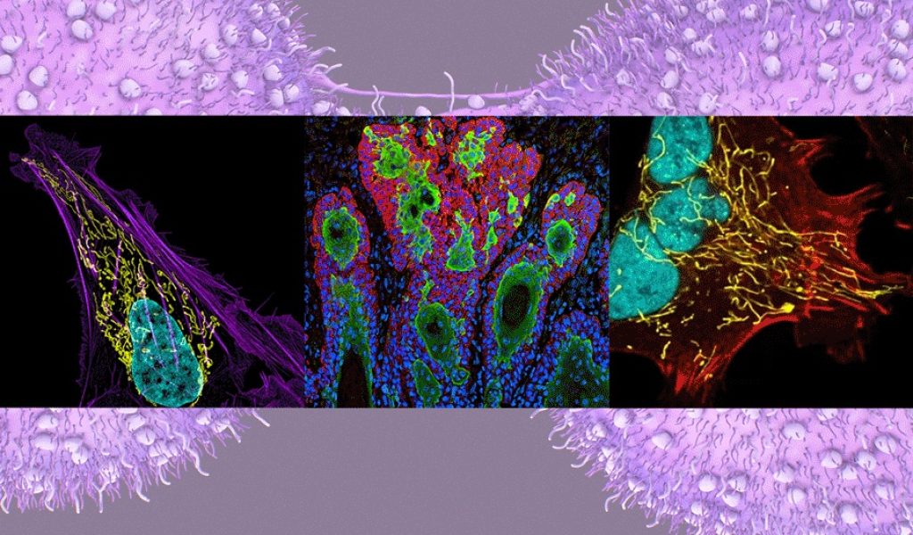 MIT-Cancer-Models-01_0