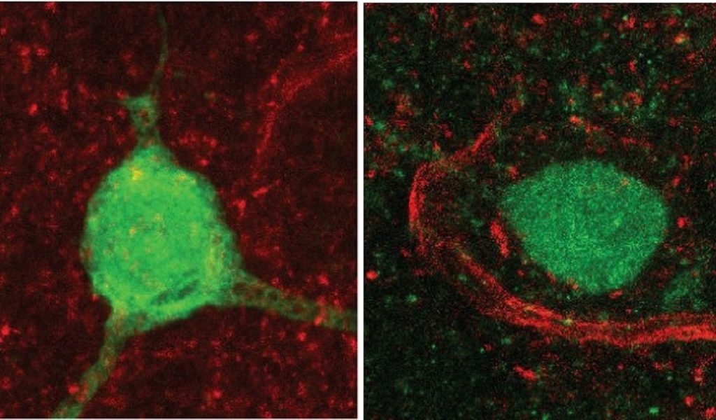 Nota_Imagen del cerebro de ratón en la que se observan neuronas productoras de vasopresina (verde) en la estría terminal (BNST)
