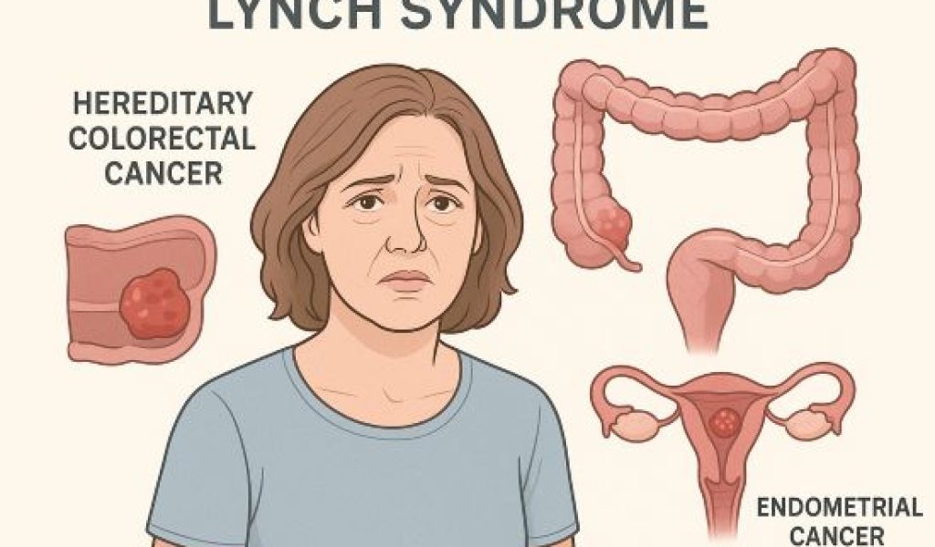Sindrome Lynch