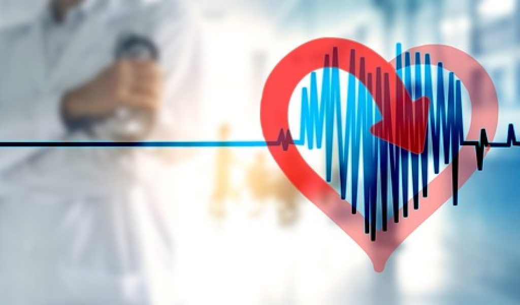 atrial-fibrillation-7832673_640